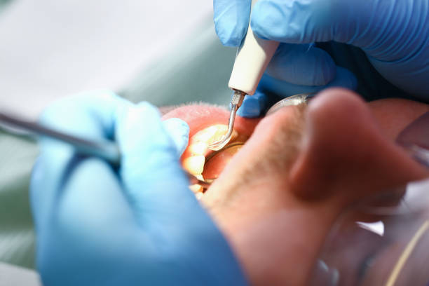Best Emergency Treatment for Dental Infections or Abscesses in North Star, DE